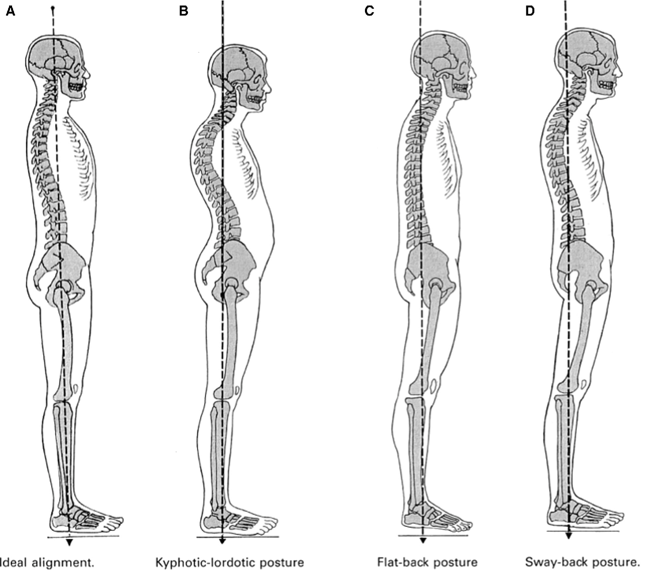 How to help fix faulty posture  