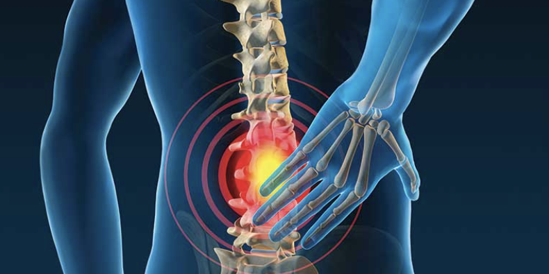 Sacroilliac joint pain 