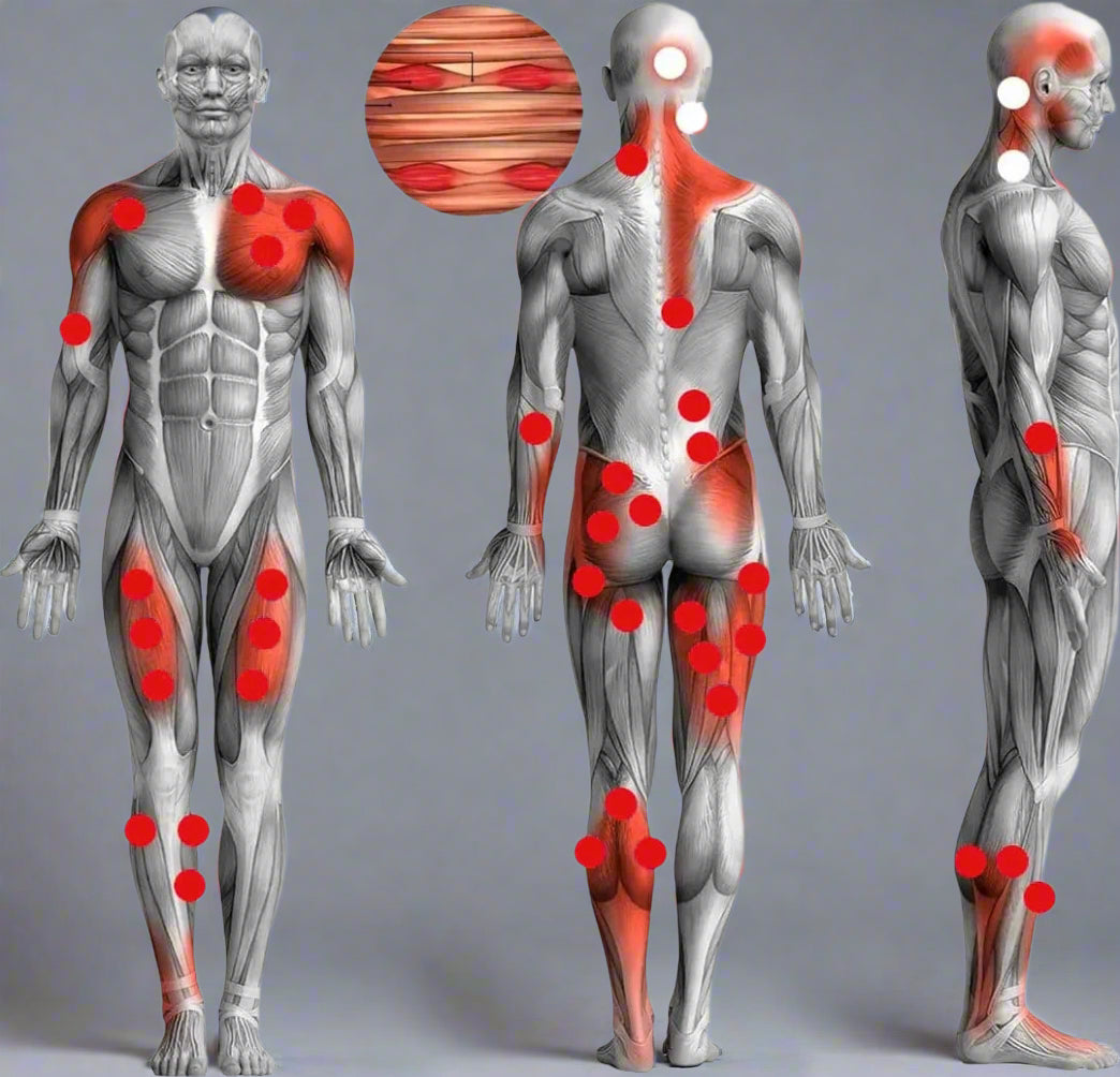 Muschle What is a Muscle Knot ,Causes & Treatment - Training Station