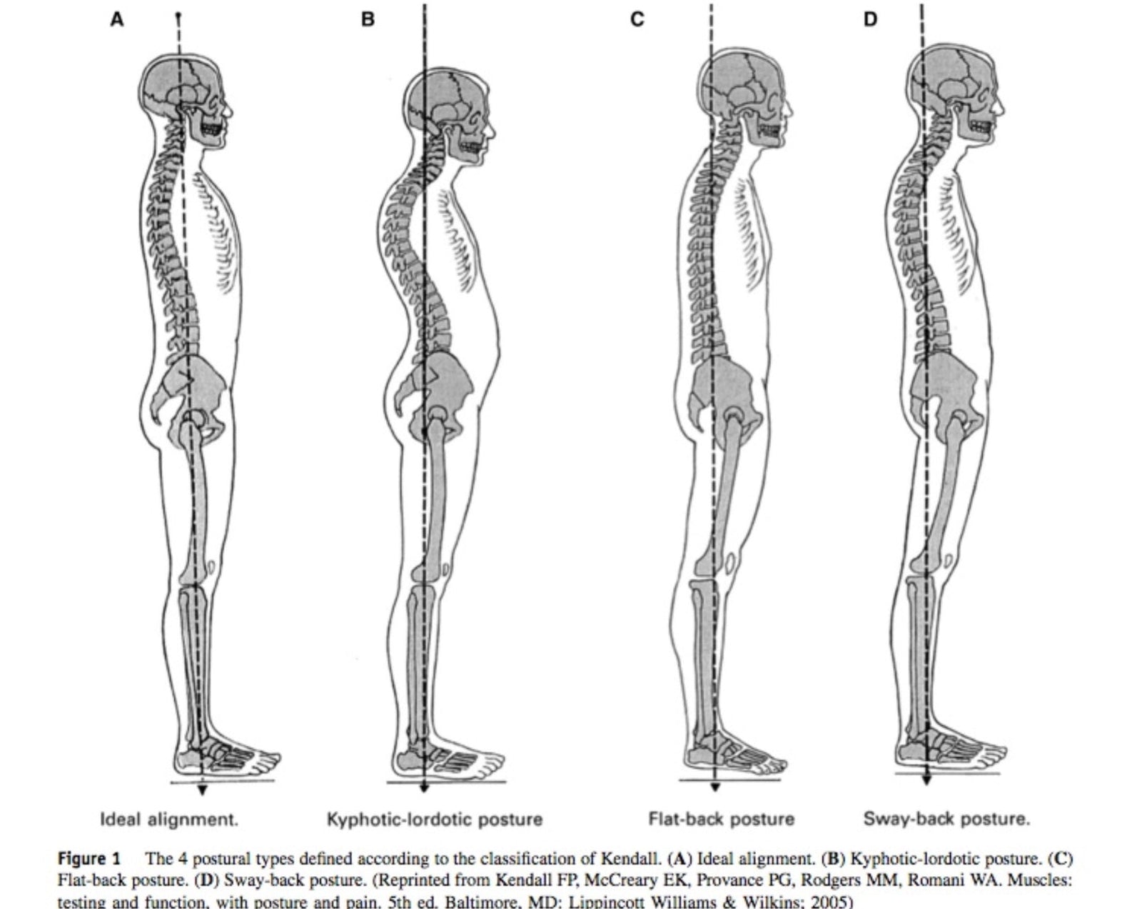 Posture - Client Assessment Ideas  